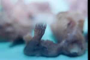 Aborto 12 semanas 04