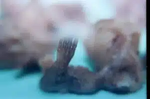 Aborto 12 semanas 04