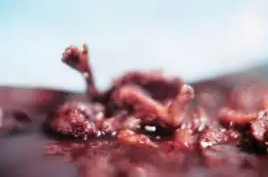 Aborto 14 semanas 01