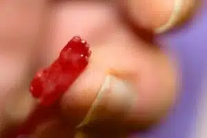Aborto 16 semanas 004