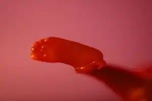 Aborto 16 semanas 009