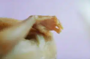 Aborto 20 semanas 02