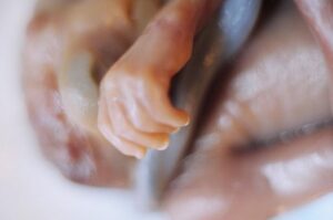Aborto 24 semanas 01