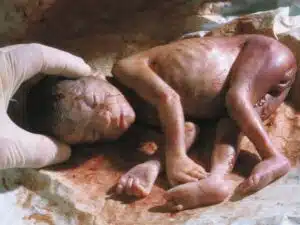 Aborto 24 semanas 09