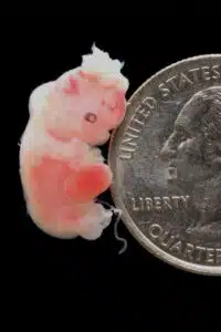 Aborto 6 semanas 02