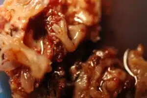 Aborto 7 semanas 02