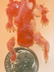 Aborto 7 semanas 07